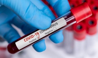 COVID-19: Bio-Warfare Conspiracy Theories Need Investigation